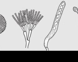 1. Endospory - AC|2. Egzospory - BD